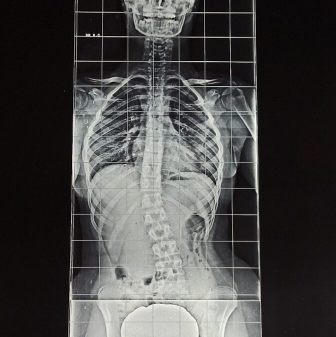 Ottimizzazione Neuroposturale associata a Terapia RMD